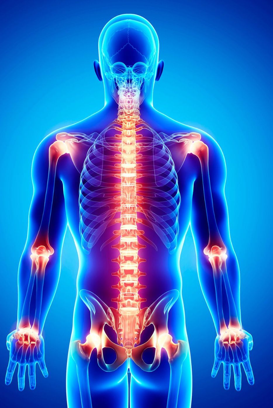 Illustration of a human body highlighting the skeletal system with glowing joints in the hands, hips, knees, and spine against a blue background. The image emphasizes areas typically affected by arthritis.